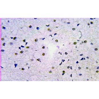 RPA2 Rabbit Polyclonal Antibody (10412-1-Ap)