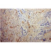 MYL12B Rabbit Polyclonal Antibody (10324-1-AP)