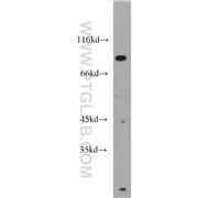 STAT1 Rabbit Polyclonal Antibody (10144-2-AP)
