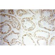 DDR1 Rabbit Polyclonal Antibody (10536-1-AP)