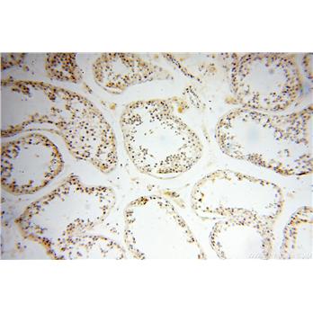 DDR1 Rabbit Polyclonal Antibody (10536-1-AP)