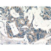 EIF3D Rabbit Polyclonal Antibody (10219-1-AP)