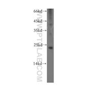 RCVRN Rabbit Polyclonal Antibody (10073-1-AP)