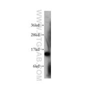 SMA4 Rabbit Polyclonal Antibody (10318-1-AP)