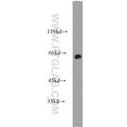 CRMP1 Rabbit Polyclonal Antibody (10317-1-AP)