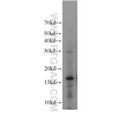 H3F3B Rabbit Polyclonal Antibody (10265-1-AP)