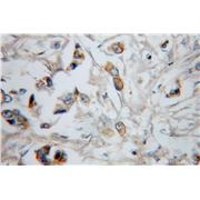 ERBB3 Rabbit Polyclonal Antibody (10369-1-AP)