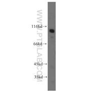 MME Rabbit Polyclonal Antibody (10302-1-AP)