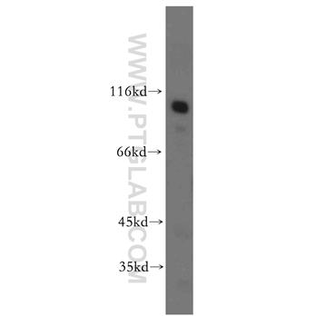 MME Rabbit Polyclonal Antibody (10302-1-AP)