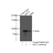 KIFC3 Rabbit Polyclonal Antibody (10125-2-AP)