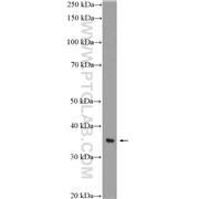 ANXA4 Rabbit Polyclonal Antibody (10087-1-AP)