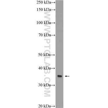ANXA4 Rabbit Polyclonal Antibody (10087-1-AP)