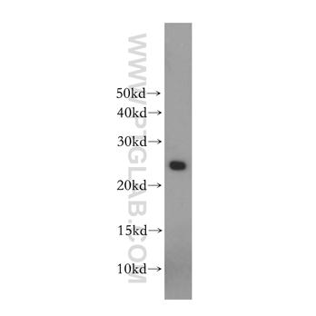 CSH1 Rabbit Polyclonal Antibody (10178-1-AP)
