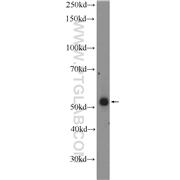 ZNF256 Rabbit Polyclonal Antibody (10360-1-AP)