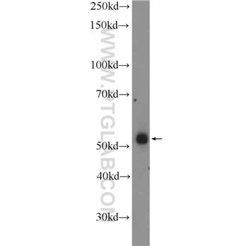 ZNF256 Rabbit Polyclonal Antibody (10360-1-AP)