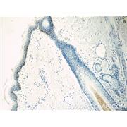 KLK5 Rabbit Polyclonal Antibody (10514-2-AP)