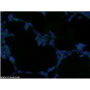 GRB2 Rabbit Polyclonal Antibody (10254-2-AP)