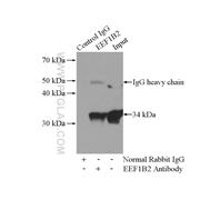 EEF1B2 Rabbit Polyclonal Antibody (10095-2-AP)