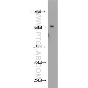 SNX1 Rabbit Polyclonal Antibody (10304-1-AP)