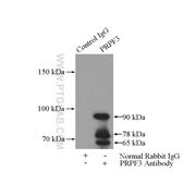 PRPF3 Rabbit Polyclonal Antibody (10106-1-AP)