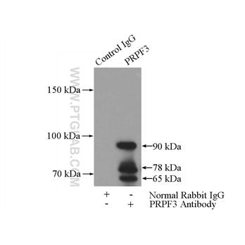 PRPF3 Rabbit Polyclonal Antibody (10106-1-AP)