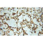 RAP1GDS1 Rabbit Polyclonal Antibody (10377-1-AP)