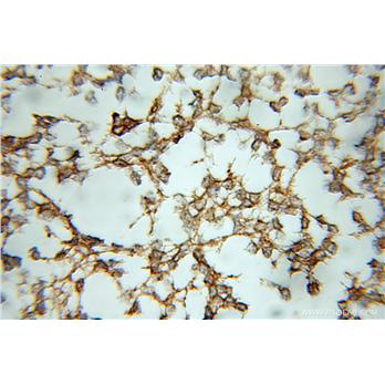 RAP1GDS1 Rabbit Polyclonal Antibody (10377-1-AP)