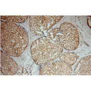 USP2 Rabbit Polyclonal Antibody (10392-1-AP)