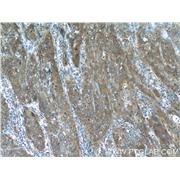 MMP1 Rabbit Polyclonal Antibody (10371-2-AP)