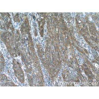 MMP1 Rabbit Polyclonal Antibody (10371-2-AP)
