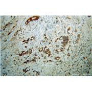 IMMT Rabbit Polyclonal Antibody (10179-1-AP)