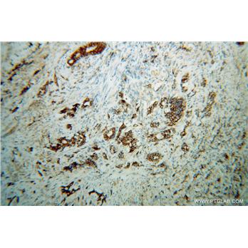 IMMT Rabbit Polyclonal Antibody (10179-1-AP)