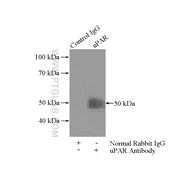 PLAUR Rabbit Polyclonal Antibody (10286-1-AP)