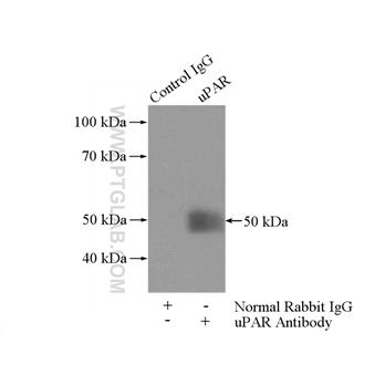 PLAUR Rabbit Polyclonal Antibody (10286-1-AP)