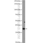 RFC2 Rabbit Polyclonal Antibody (10410-1-AP)