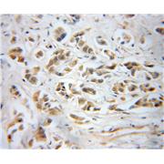 PPP1CB Rabbit Polyclonal Antibody (10140-2-AP)