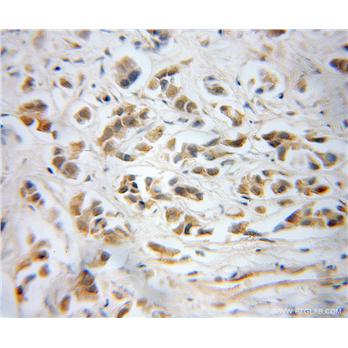 PPP1CB Rabbit Polyclonal Antibody (10140-2-AP)