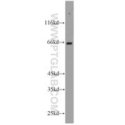 FAF1 Rabbit Polyclonal Antibody (10271-1-AP)