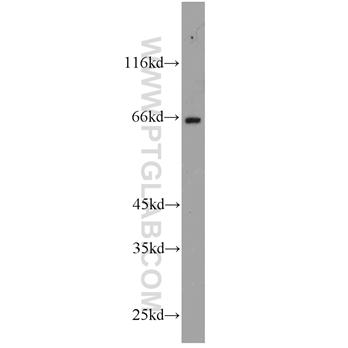 FAF1 Rabbit Polyclonal Antibody (10271-1-AP)