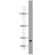 SAE1 Rabbit Polyclonal Antibody (10229-1-AP)