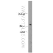 Notch1 Rabbit Polyclonal Antibody (10062-2-AP)