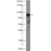 LPO Rabbit Polyclonal Antibody (10376-1-AP)