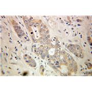 TOR1A Rabbit Polyclonal Antibody (10296-1-AP)