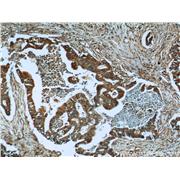 PLAT Rabbit Polyclonal Antibody (10147-1-AP)