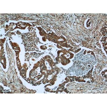 PLAT Rabbit Polyclonal Antibody (10147-1-AP)