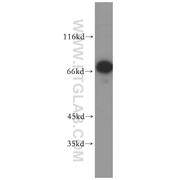 TRAP1 Rabbit Polyclonal Antibody (10325-1-AP)