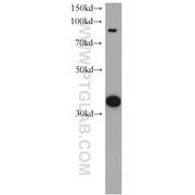 CYC1 Rabbit Polyclonal Antibody (10242-1-AP)