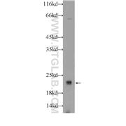 COPS8 Rabbit Polyclonal Antibody (10089-2-AP)