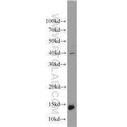 NRGN Rabbit Polyclonal Antibody (10440-1-AP)