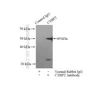 CTBP2 Rabbit Polyclonal Antibody (10346-1-AP)